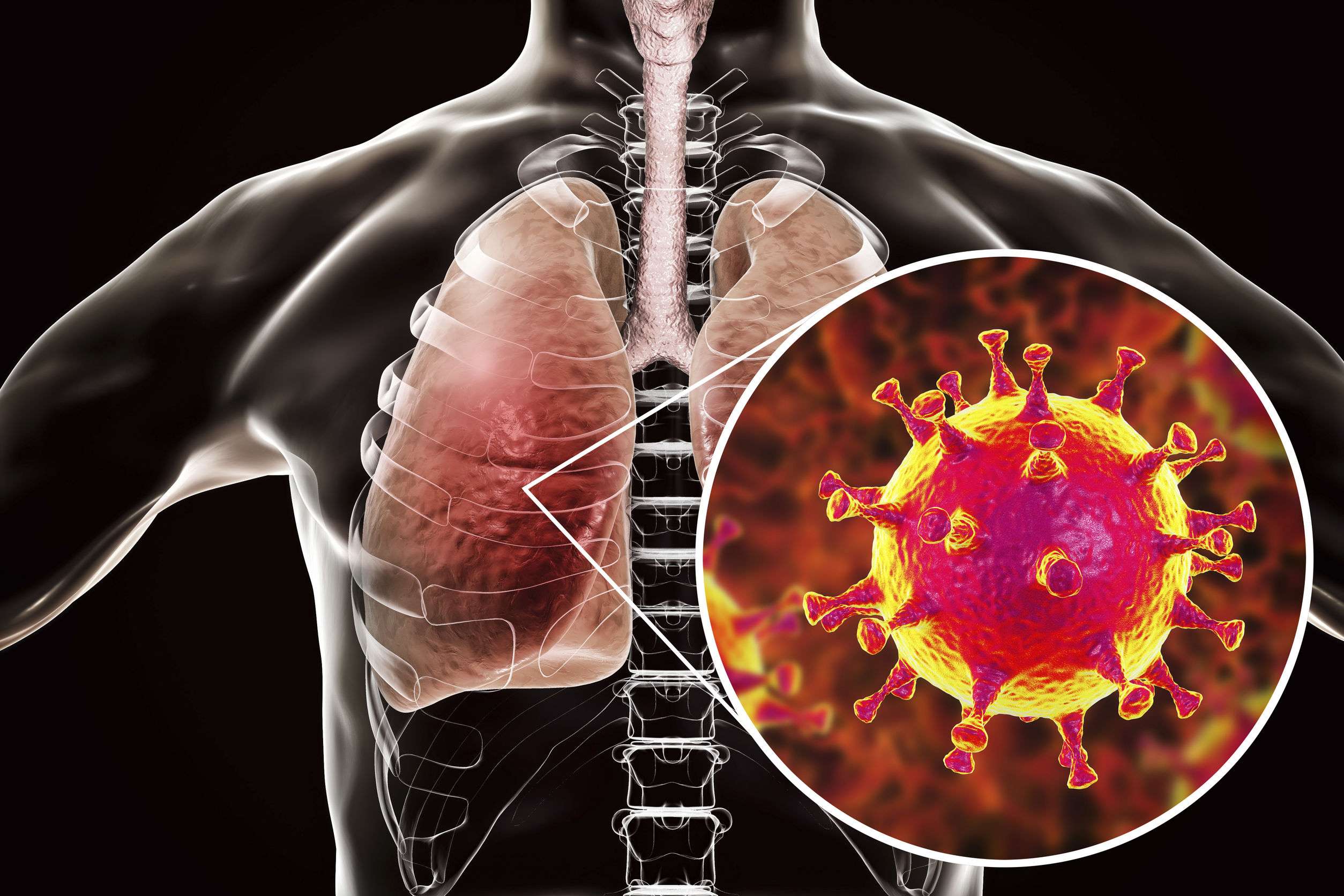 Cómo Protegerte del Coronavirus